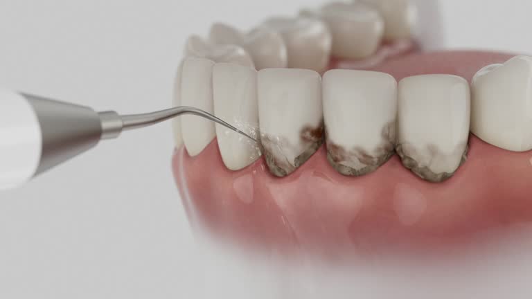 Reliable Tooth Extraction contractor in Grayson County County, TX by Dentist Open Now